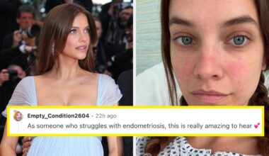 Barbara Palvin Pregnancy After Endometriosis Struggles