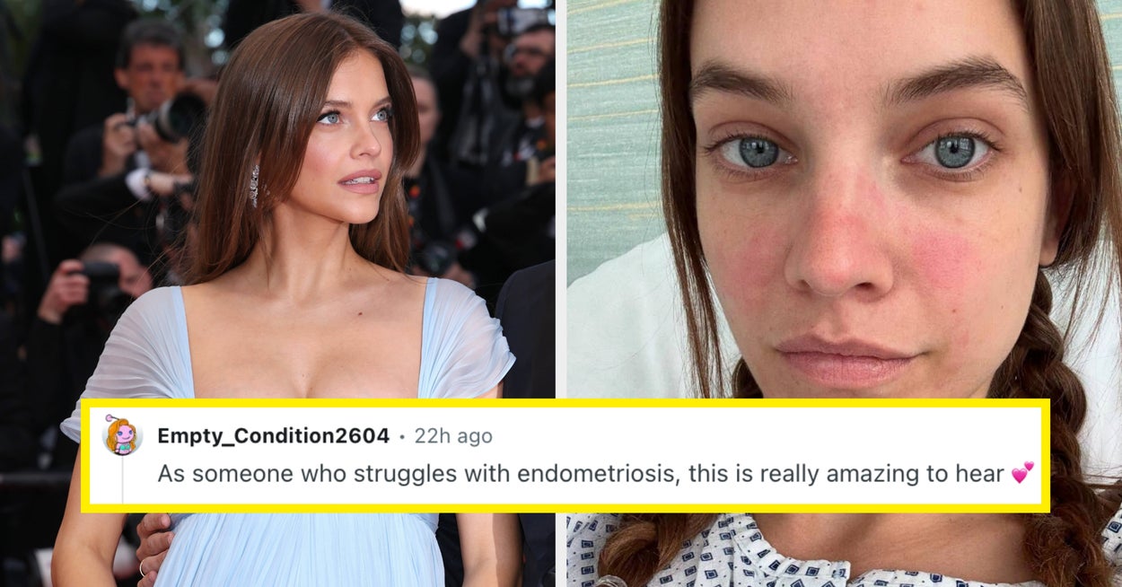 Barbara Palvin Pregnancy After Endometriosis Struggles