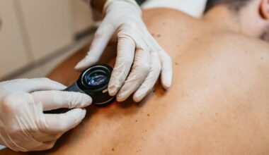 Free skin cancer screening in Cork city centre hospital tomorrow morning