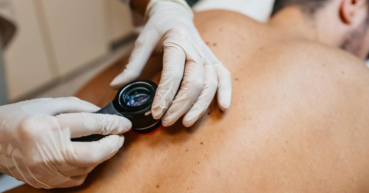 Free skin cancer screening in Cork city centre hospital tomorrow morning