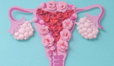 Six early signs of PCOS often overlooked