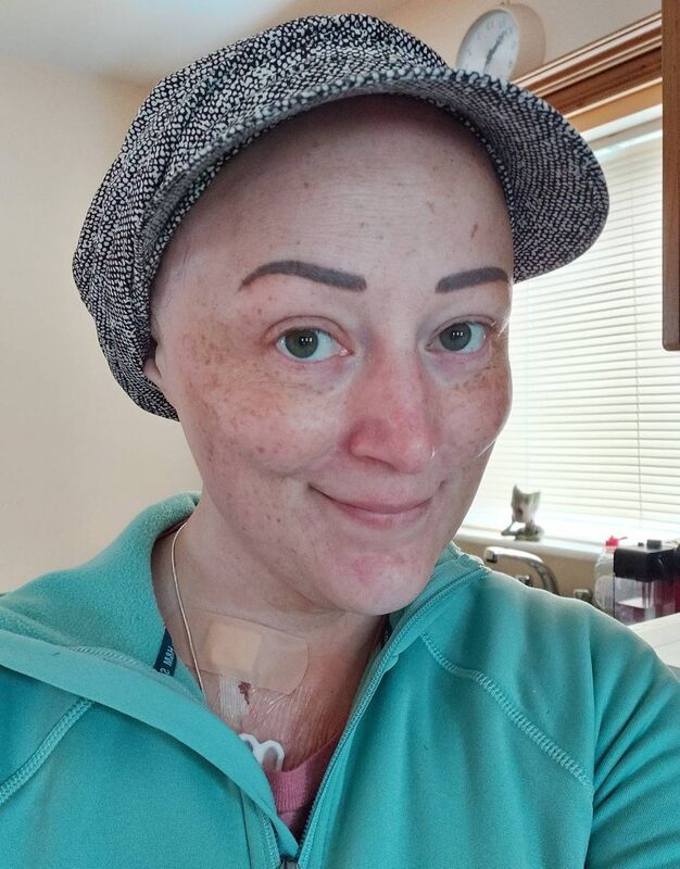 Elaine Walsh in October 2020 during treatment. 