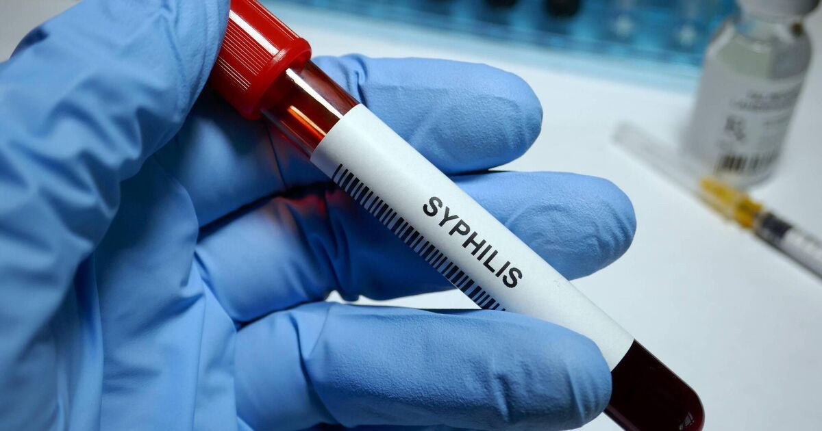 STIs reach record levels across Europe, with gonorrhoea seeing 303% increase