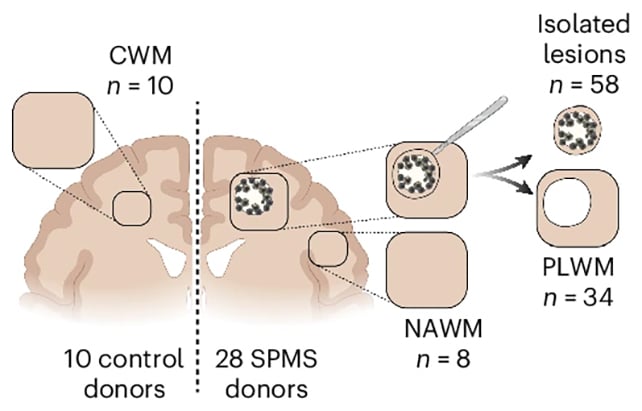 Brain tissue samples
