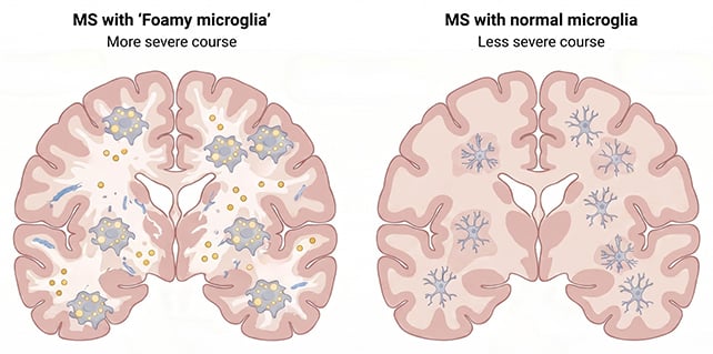 Microglia analysis