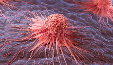 Cancer Cell Spread Abnormal Growth