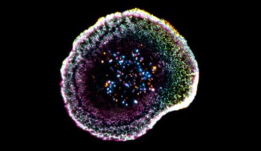 Cytotoxic T Cell