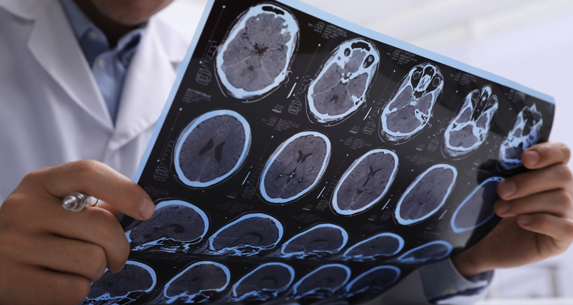 Doctor Examining MRI Scans