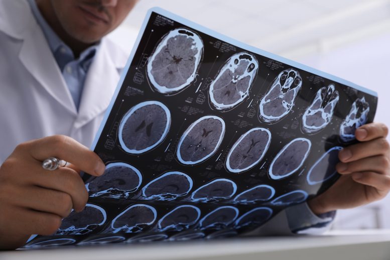 Doctor Examining MRI Scans