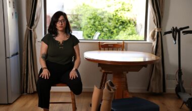 Disabled woman left ‘extremely stressed’ after prosthetic legs lost on flights from Brazil – The Irish Times