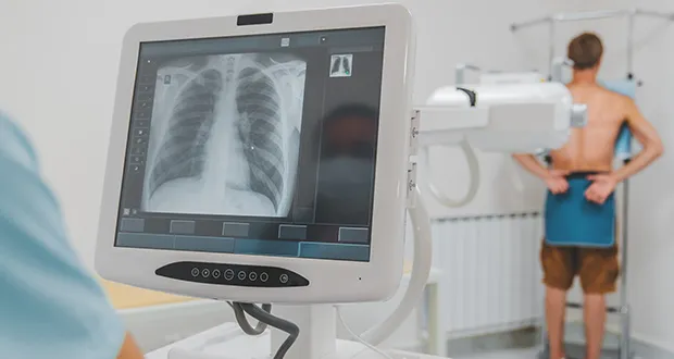 lung screening