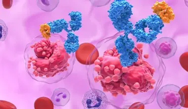 Acute lymphocytic leukemia