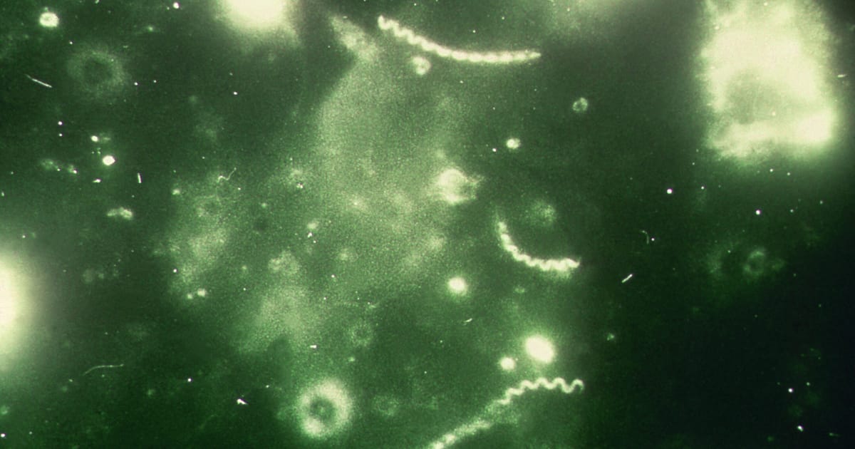 Gonorrhea and syphilis cases hit record highs in Europe – POLITICO