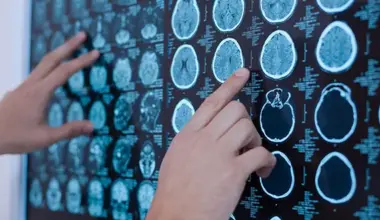 neurology