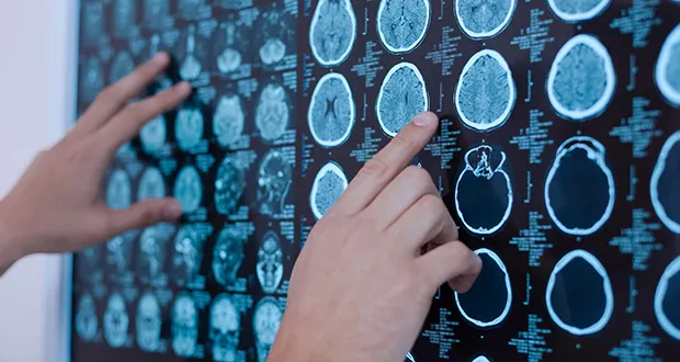 neurology