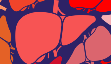 Macrophage Therapy Shows Promise Against Cirrhosis