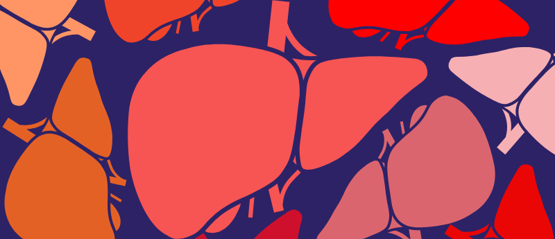 Macrophage Therapy Shows Promise Against Cirrhosis