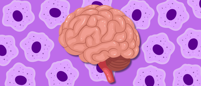 Clinical Trial Assessing MSCs in Mild Alzheimer's Disease