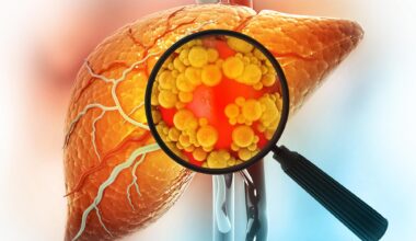 Magnifying Glass Showing Diseased Liver