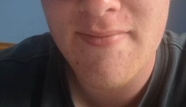 Leaving Cert and diabetes: ‘I used to be going constantly in and out of class, going to the first aid room’ – The Irish Times