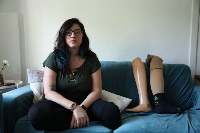 Sara Ribeiro's bag was lost by an airline with two of her prosthetic legs inside. Photograph: Enda O'Dowd