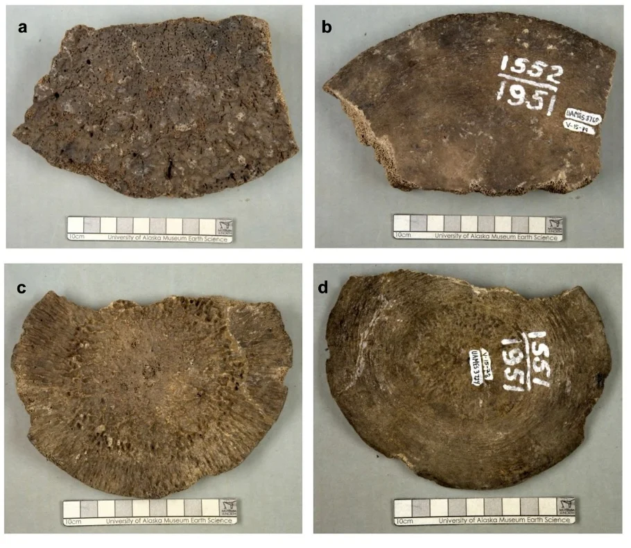 two epiphyseal plates