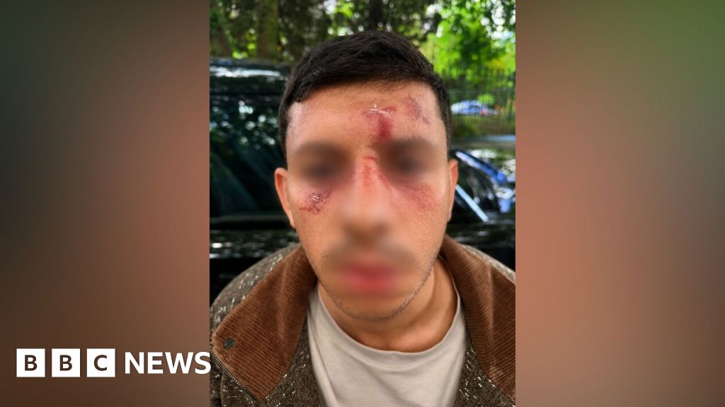 Jewish man 'kicked like animal' as police probe antisemitic attack - BBC