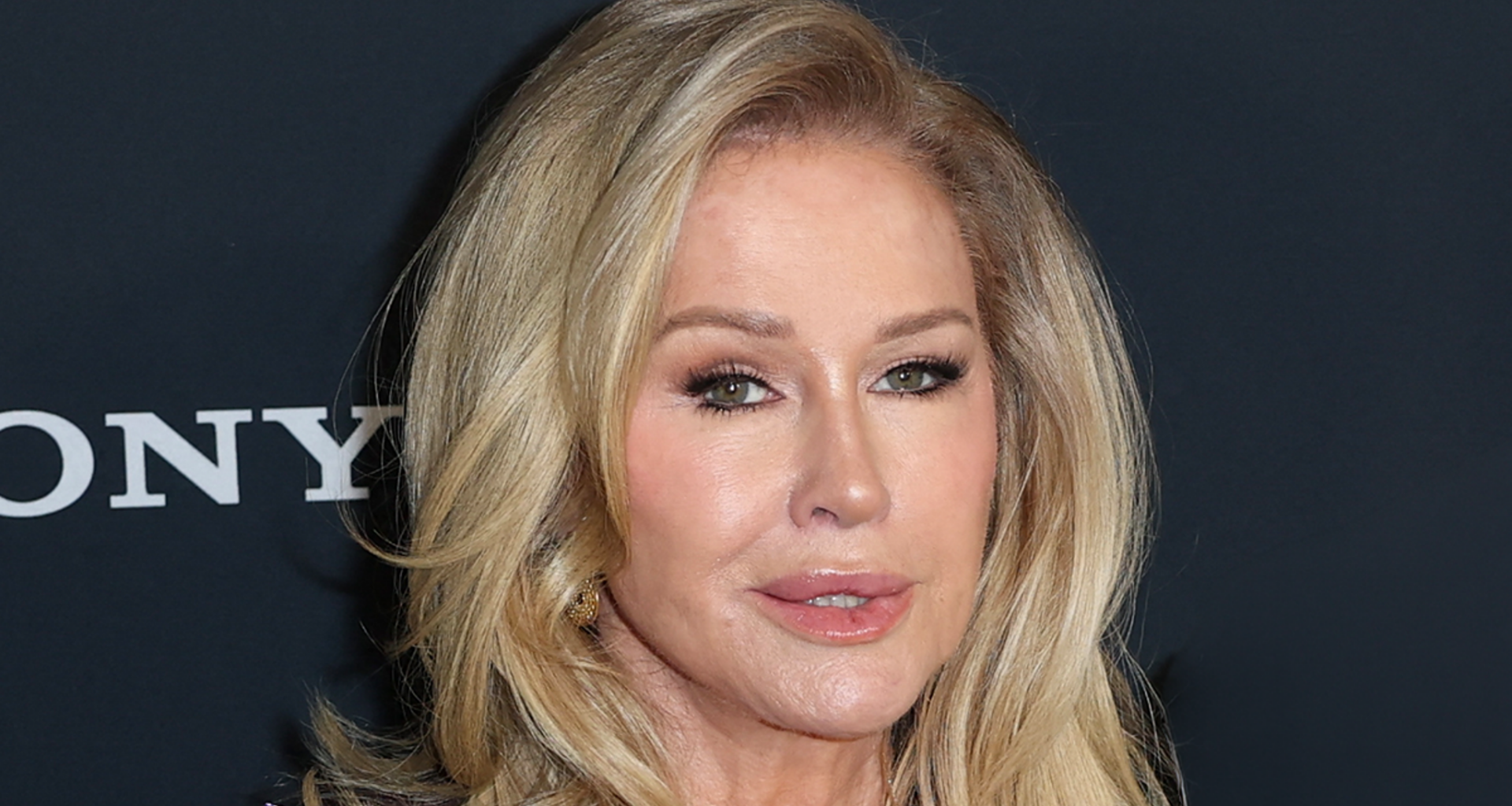'RHOBH’ Kathy Hilton Fighting Injured House Guest Over $$$ Demand