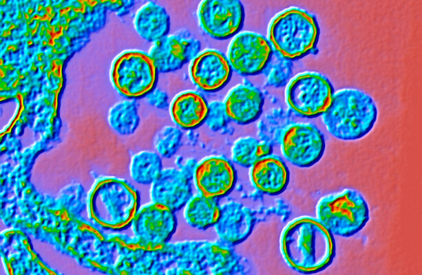 What to know about the potentially fatal disease and the outbreak on a cruise ship