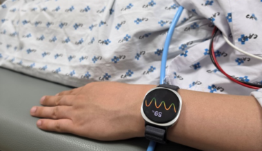 Samsung Galaxy Watch Can Predict Fainting Spells, Clinical Study Reveals
