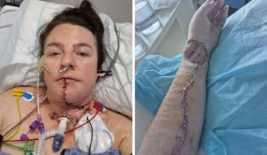 Co Armagh woman’s niggling ‘mouth ulcer’ turned out to be stage four cancer – Armagh I