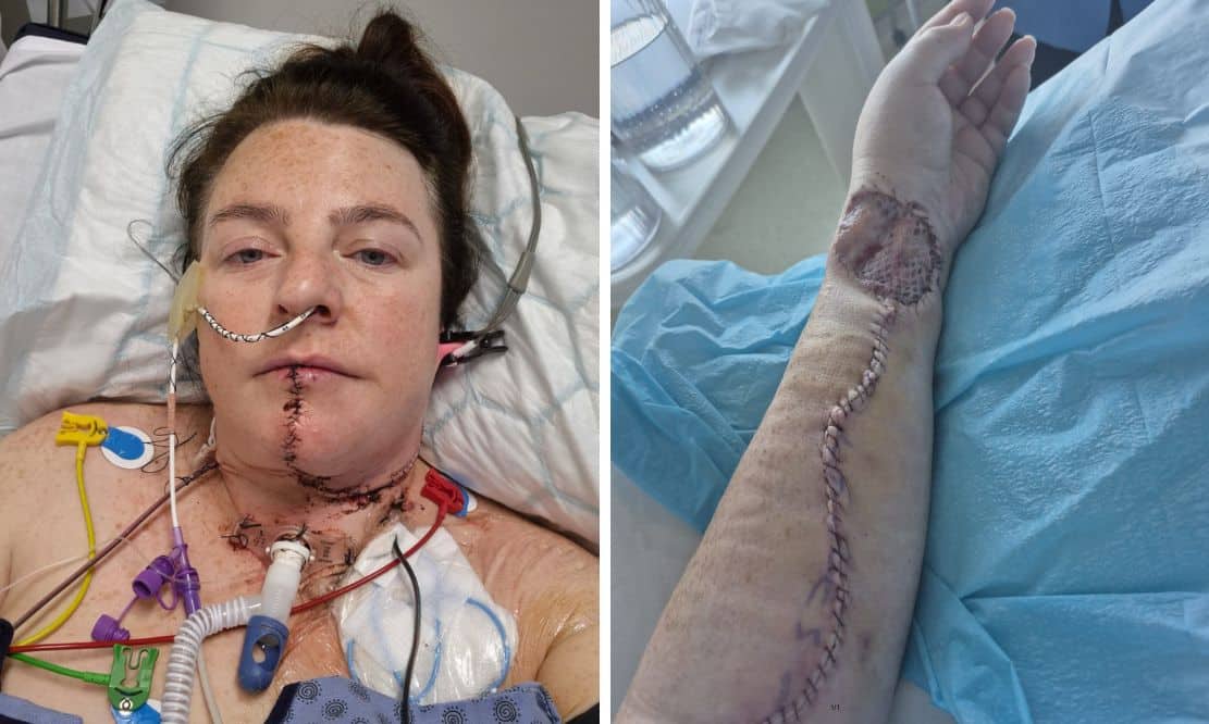 Co Armagh woman’s niggling ‘mouth ulcer’ turned out to be stage four cancer – Armagh I