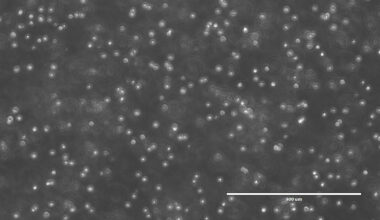 Dozens of small, white cells cover a dark grey background. There are clusters of cells that are touching, and some are spread apart. Some of the cells have brighter areas in the middle, and some appear dull as if they are further away.