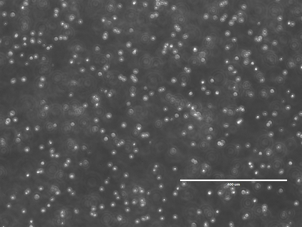 Dozens of small, white cells cover a dark grey background. There are clusters of cells that are touching, and some are spread apart. Some of the cells have brighter areas in the middle, and some appear dull as if they are further away.
