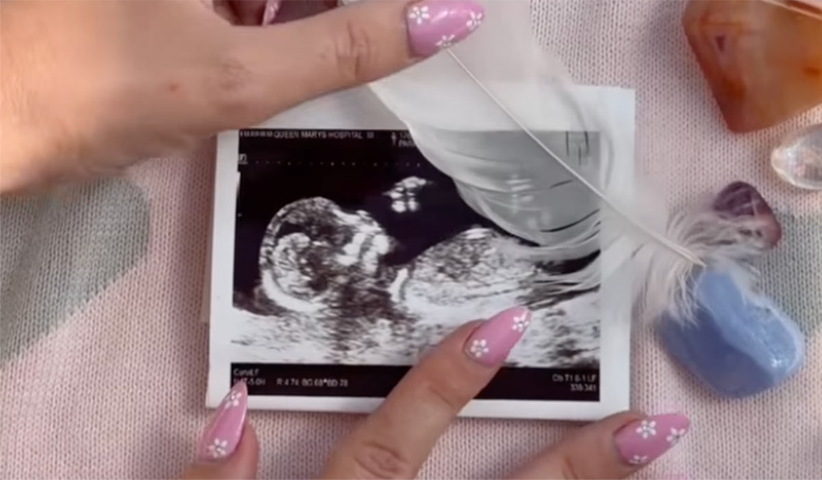 Kelsey Parker is expecting a rainbow baby. Pic: Kelsey Parker / Instagram