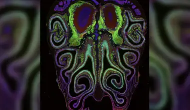 A microscope photo of a cross section of a mouse nose. green fluorescent colour highlights smell neurons. A small subset of dying neurons is labeled in red.