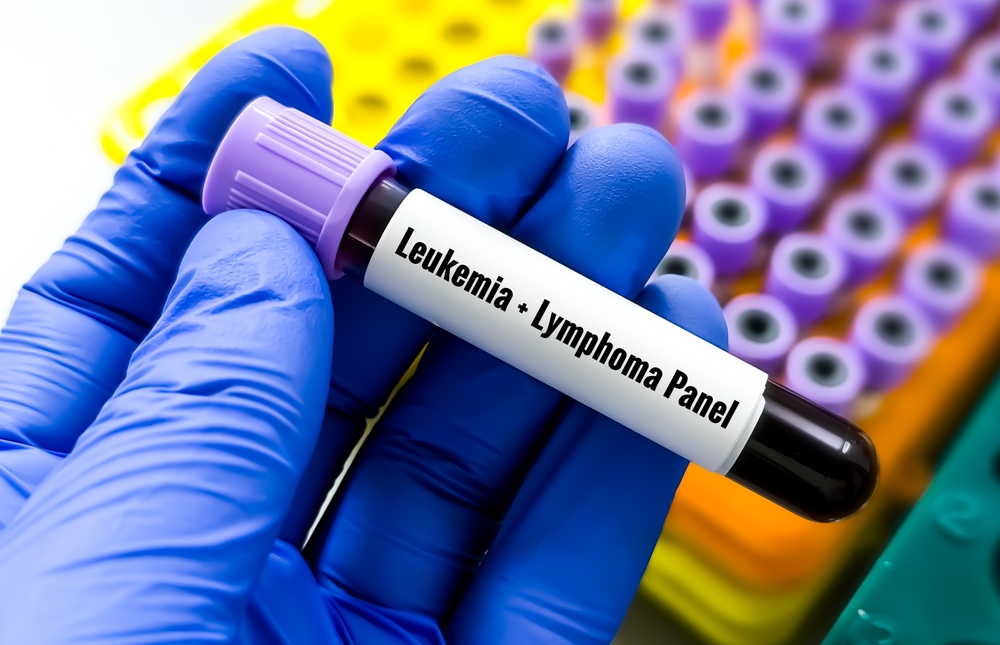Early forever chemicals exposure linked to higher lymphoblastic leukaemia risk in children