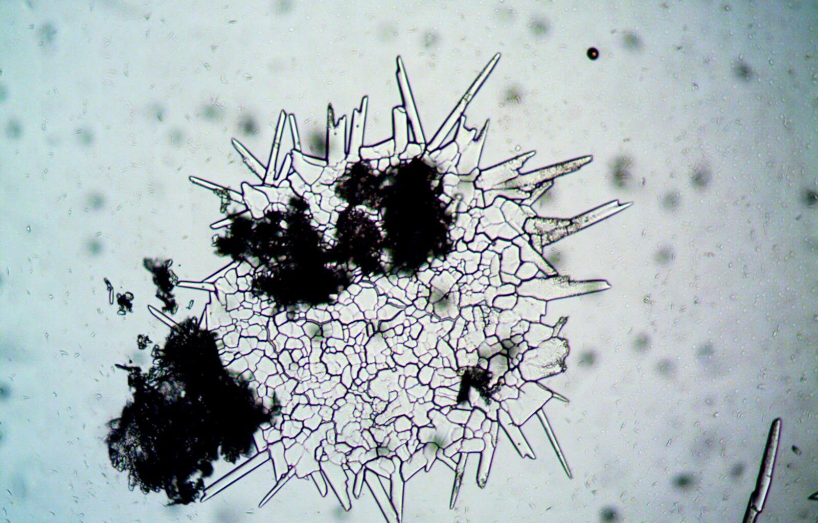 Tardigrades can survive being boiled, frozen to near absolute zero, blasted with radiation, and exposed to the vacuum of space, and they do it by drying themselves into a glass-like state where every cellular process stops and they wait, sometimes for decades, for water to come back.