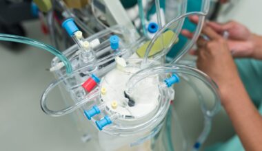 Cardiac specialists to take strike action next week
