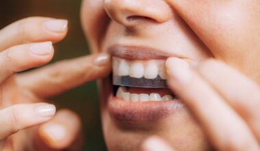 Warning over illegal and unsafe teeth-whitening products