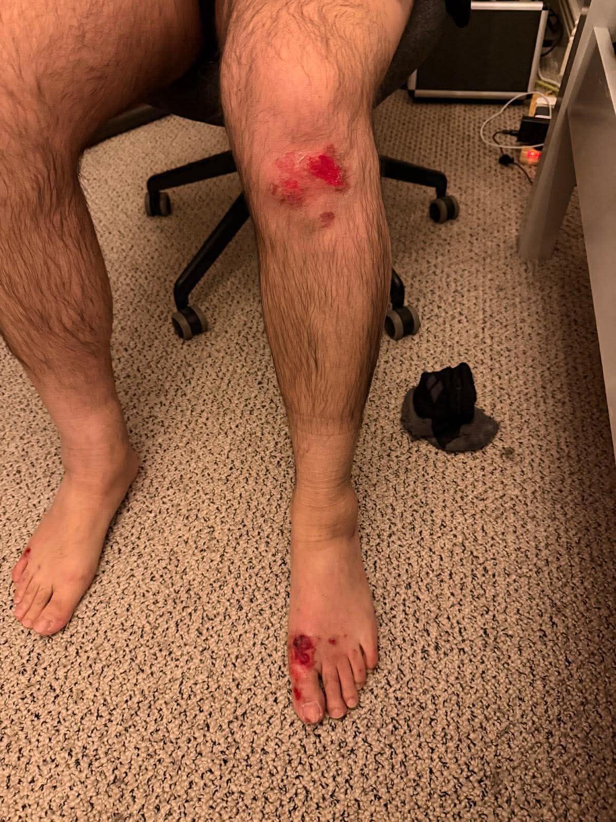Mustafa Duman shows his injuries after an attack from a DoneDeal buyer