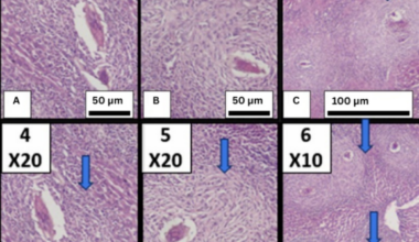 In vivo assessment of anti-helminthic and anti-inflammatory effects of Fucoidan on Schistosoma mansoni immature stages