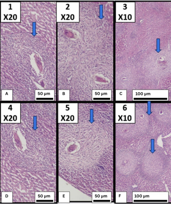 In vivo assessment of anti-helminthic and anti-inflammatory effects of Fucoidan on Schistosoma mansoni immature stages