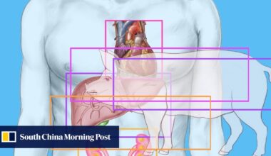 China performs world’s first combined transplant of pig liver and kidney to human