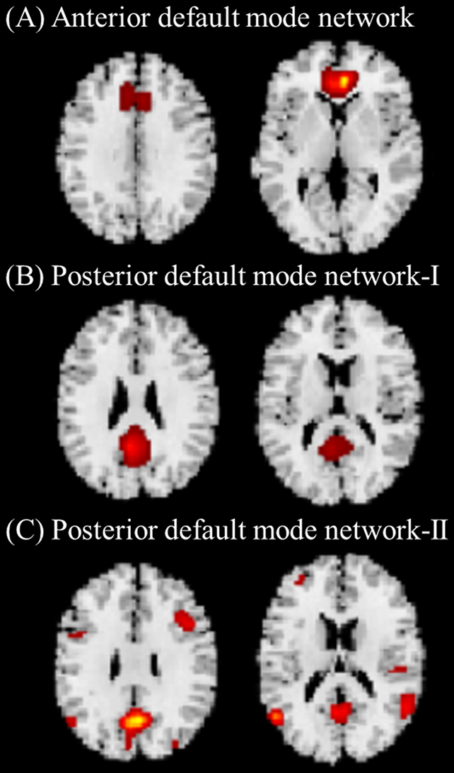 Brain connectivity