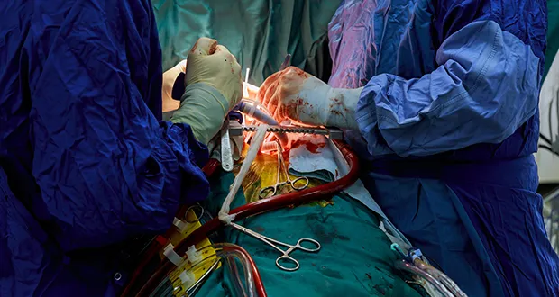 mital valve