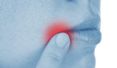 Varicella-zoster virus inflicts lasting damage to nerves and the brain, study reveals