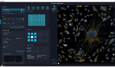 AI-driven high-content screening