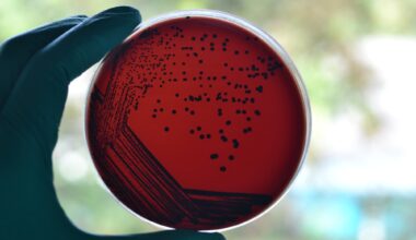 Australia’s diphtheria outbreak shows why boosters, antibiotics, and better housing all matter
