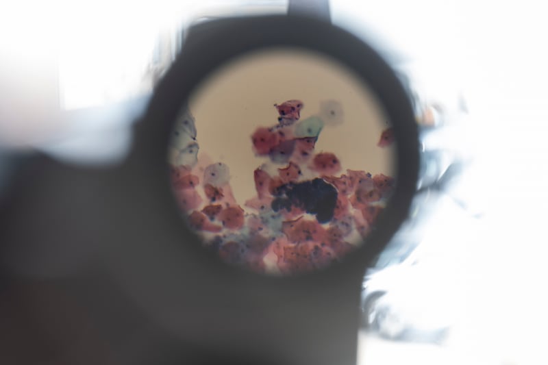 Microscopic view of a test sample in the cytology screening laboratory at the NCSL. Photograph: Paulo Nunes dos Santos